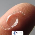 ¿Qué son los lentes intraoculares y que tipos hay?